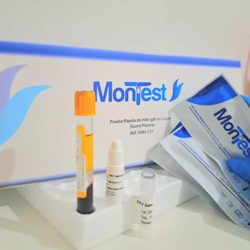 Prueba de Hepatitis A - HAV IgM