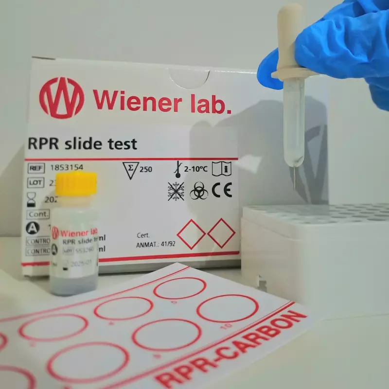 Examen de RPR (SIFILIS)