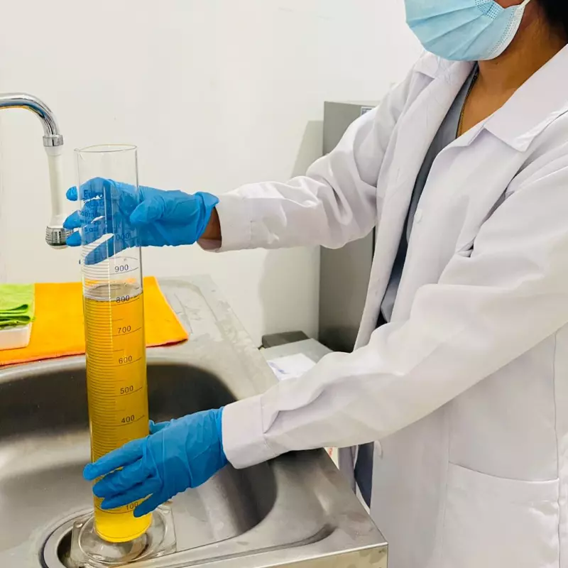 Proteinuria, Orina de 24 horas