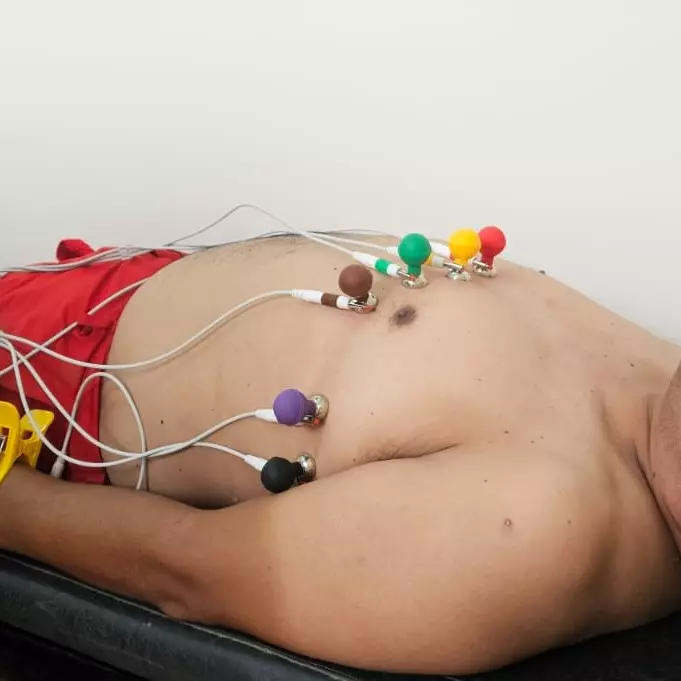 ELECTROCARDIOGRAMA