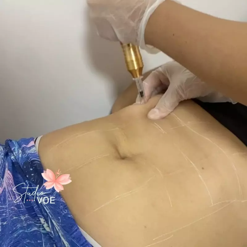 Enzimas sem agulha