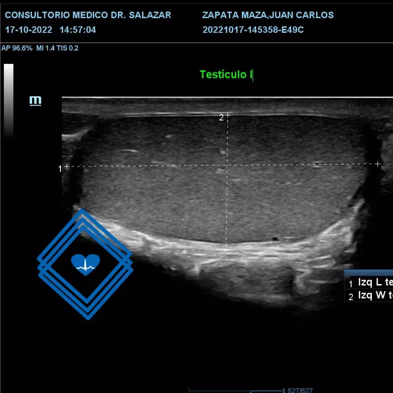 ECOGRAFIA TESTICULAR