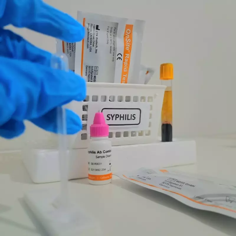 Prueba Rápida de Sífilis