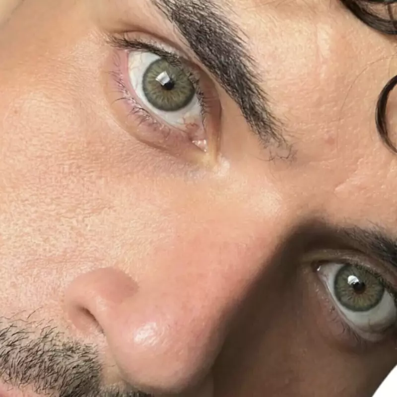 Breze green hiperrealistas espec  🍀